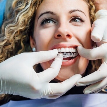 Allen cosmetic dentist placing an Invisalign clear aligner in a patient's mouth