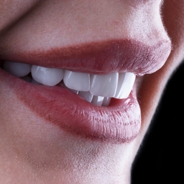 Close up of a person's smile with straight white teeth