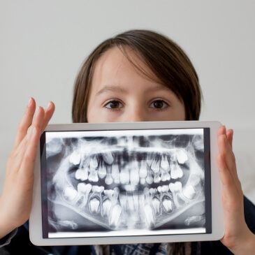 Person holding tablet showing dental x rays in front of their face