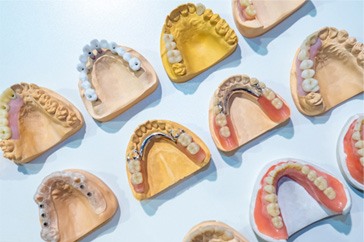 The types of dentures in Allen
