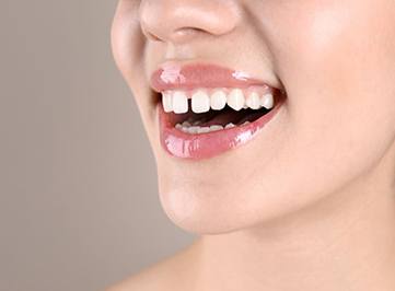 Woman’s smile with gap between front teeth