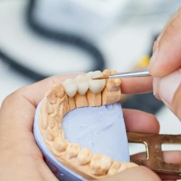 Close up of a person's hand crafting a dental bridge to replace missing teeth in Allen